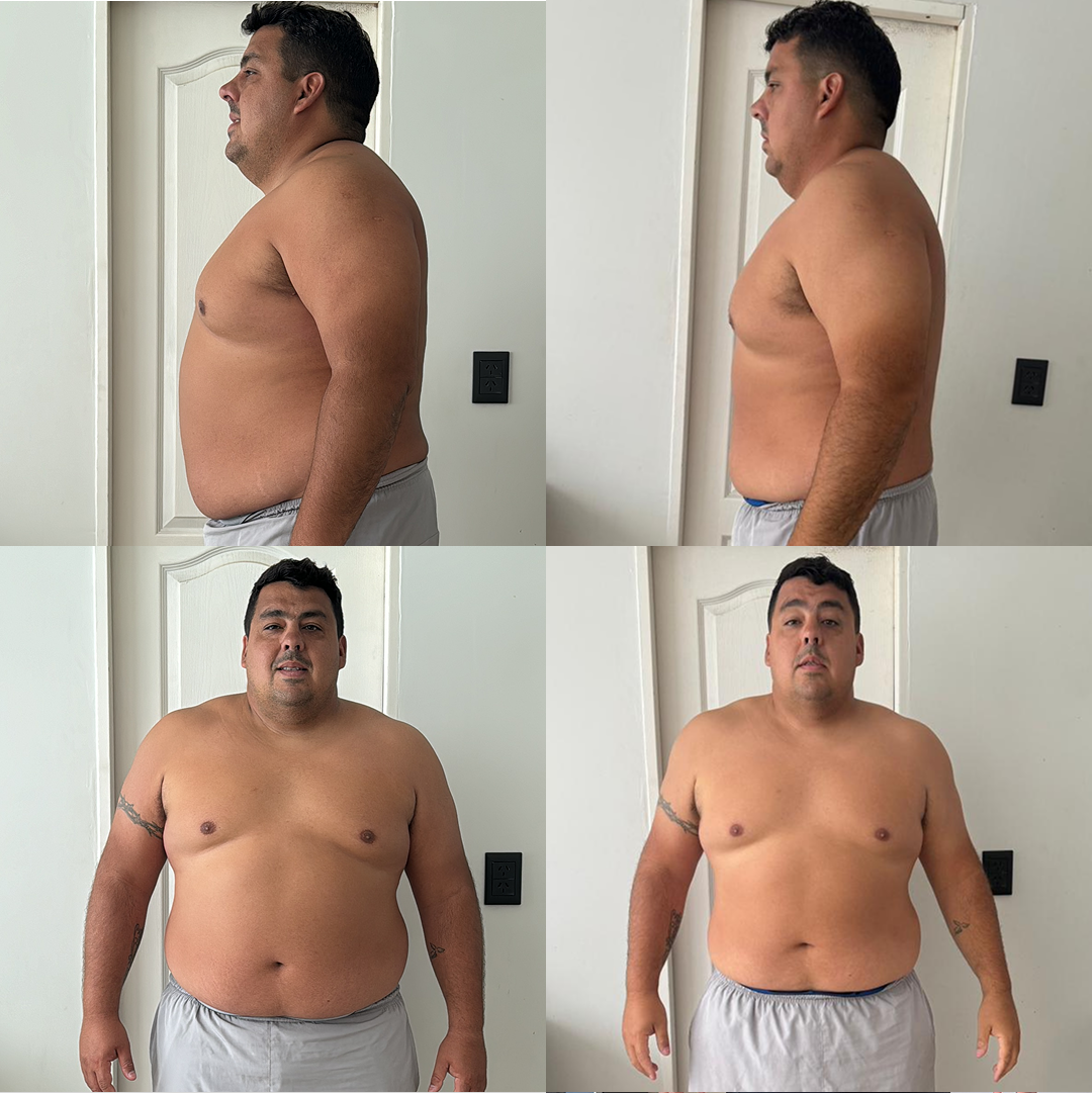 Elias Rougier Fit - cambio 3